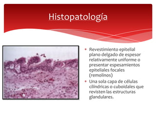 Histopatología
Revestimiento epitelial
plano delgado de espesor
relativamente uniforme o
presentar espesamientos
epiteliales focales
(remolinos)
Una sola capa de células
cilíndricas o cuboidales que
revisten las estructuras
glandulares.
 
