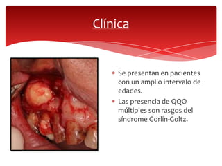 Clínica
Se presentan en pacientes
con un amplio intervalo de
edades.
Las presencia de QQO
múltiples son rasgos del
síndrome Gorlin-Goltz.
 