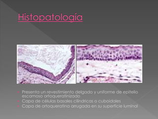  Presenta un revestimiento delgado y uniforme de epitelio
escamoso ortoqueratinizado
 Capa de células basales cilíndricas o cuboidales
 Capa de ortoqueratina arrugada en su superficie luminal
 