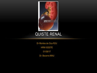 Dr Montes de Oca R2U
HRM ISSSTE
01/08/17
Dr. Becerra MAU
QUISTE RENAL
 