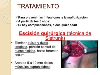 TRATAMIENTO
Para prevenir las infecciones y la malignización
A partir de los 3 años
Si hay complicaciones, a cualquier edad
Escisión quirúrgica (técnica de
Sistrunk)
• Eliminar quiste y ducto
tirogloso, porción central del
hueso hioides, hasta foramen
cecum.
• Área de 5 a 10 mm de los
músculos suprahioideos
 