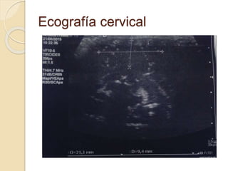 Ecografía cervical
 