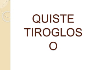 QUISTE
TIROGLOS
O
 