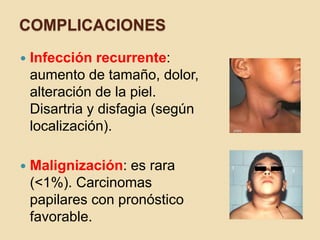 COMPLICACIONES
 Infección recurrente:
aumento de tamaño, dolor,
alteración de la piel.
Disartria y disfagia (según
localización).
 Malignización: es rara
(<1%). Carcinomas
papilares con pronóstico
favorable.
 