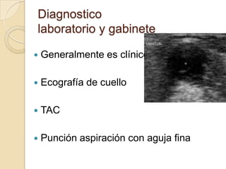 Diagnostico
laboratorio y gabinete

   Generalmente es clínico

   Ecografía de cuello

   TAC

   Punción aspiración con aguja fina
 