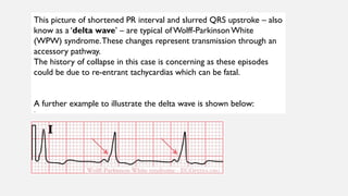 quiz for critical care doctors includes imaging, ecg | PPTX
