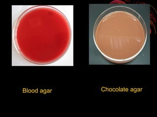 Blood agar

Chocolate agar

 