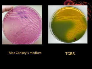Mac Conkey’s medium

TCBS

 