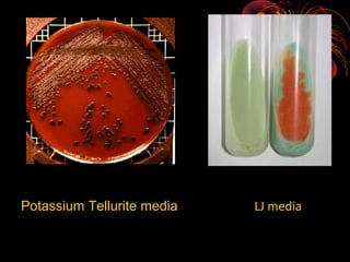 Potassium Tellurite media

LJ media

 