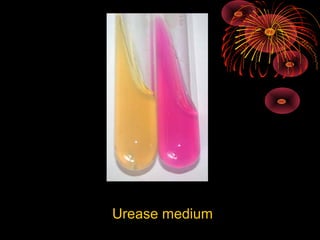 Urease medium

 