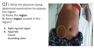 Quiz 1 Abdomen this quiz help students .pdf