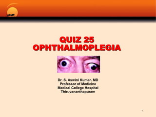 Quiz 25Ophthalmoplegia Dr. S. Aswini Kumar. MD Professor of Medicine Medical College Hospital Thiruvananthapuram 1 