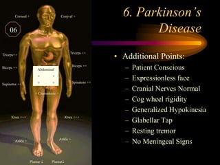 6. Parkinson’s Disease<br />.<br />Conjval +<br />Corneal +<br />Jaw -<br />Triceps ++<br />Triceps++<br />Biceps ++<br />...