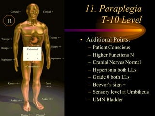 11. ParaplegiaT-10 Level <br />.<br />Conjval +<br />Corneal +<br />Jaw -<br />Triceps ++<br />Triceps++<br />Biceps ++<br...