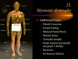 25. Myotonic dystrophy <br />.<br />Conjval +<br />Corneal +<br />Jaw -<br />Triceps+-<br />Triceps+<br />Biceps +<br />Bi...