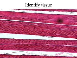 Identify tissue 