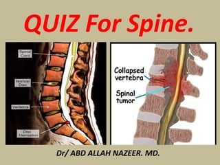 QUIZ For Spine.
Dr/ ABD ALLAH NAZEER. MD.
 