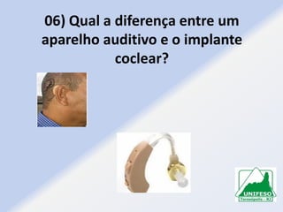 06) Qual a diferença entre um
aparelho auditivo e o implante
coclear?

 
