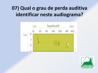 07) Qual o grau de perda auditiva
identificar neste audiograma?

 
