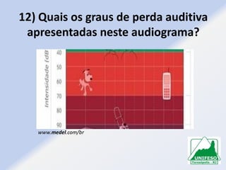 12) Quais os graus de perda auditiva
apresentadas neste audiograma?

www.medel.com/br

 