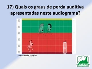 17) Quais os graus de perda auditiva
apresentadas neste audiograma?

www.medel.com/br

 