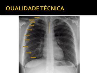 Aula prática de radiologia