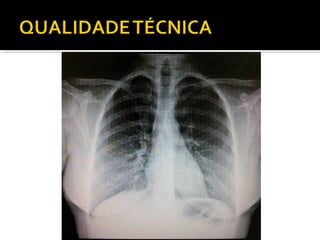 Aula prática de radiologia