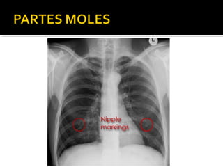 Aula prática de radiologia