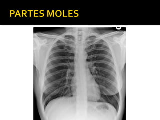 Aula prática de radiologia