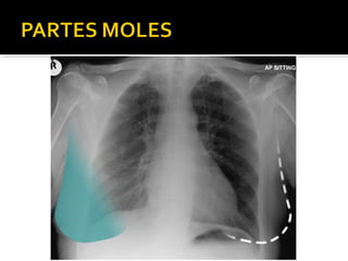Aula prática de radiologia