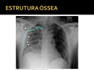 Aula prática de radiologia