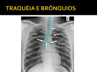 Aula prática de radiologia