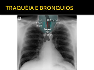 Aula prática de radiologia