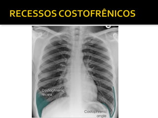 Aula prática de radiologia