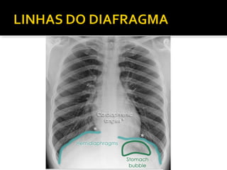 Aula prática de radiologia