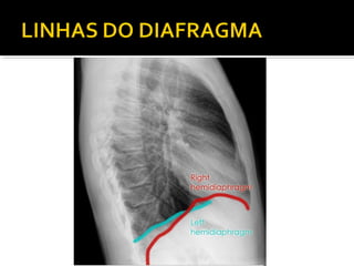 Aula prática de radiologia