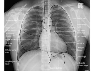 Aula prática de radiologia