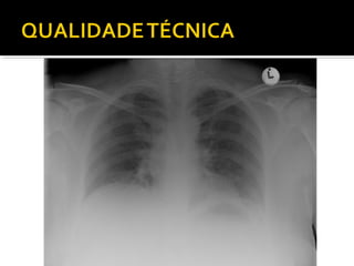 Aula prática de radiologia