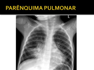 Aula prática de radiologia