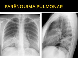 Aula prática de radiologia
