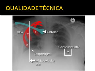 Aula prática de radiologia