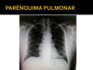 Aula prática de radiologia