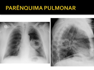 Aula prática de radiologia
