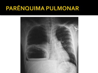 Aula prática de radiologia