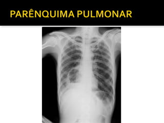 Aula prática de radiologia