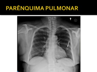 Aula prática de radiologia