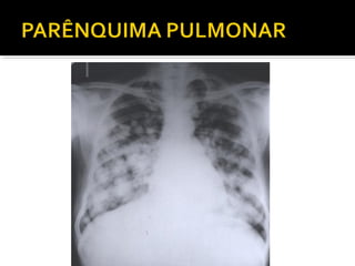 Aula prática de radiologia