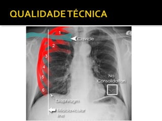 Aula prática de radiologia