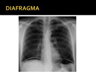 Aula prática de radiologia