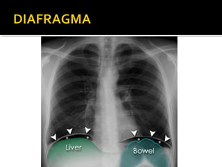 Aula prática de radiologia